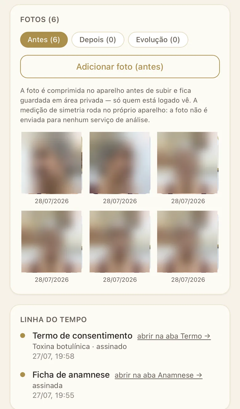 Prontuário aberto durante a avaliação presencial: seis fotos do dia arquivadas com a data, separadas nas abas Antes, Depois e Evolução, o aviso de que a foto fica em área privada e a medição roda no próprio aparelho, e a linha do tempo com termo de consentimento e ficha de anamnese já assinados. Os rostos aparecem borrados.